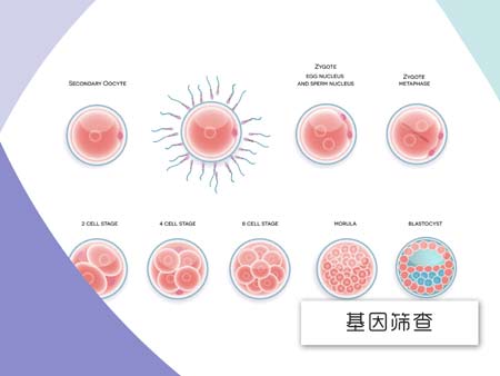 格鲁吉亚试管婴儿
